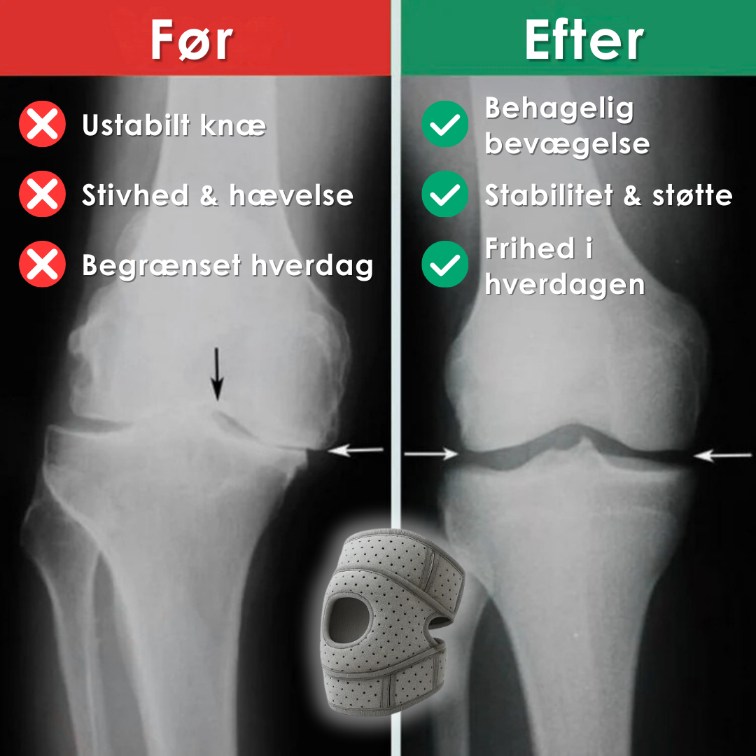 OrthoKnee Pro™ – For en hverdag uden knæsmerter